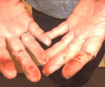 Jak a jak čistit mangan z rukou a nehtů doma